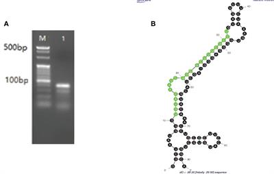 A Novel MicroRNA and the Target Gene TAB2 Can Regulate the Process of Sucking Blood in and the Spawn Rate of Hyalomma asiaticum (Acari: Ixodidae) Ticks